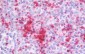 TGFB1 / TGF Beta 1 Antibody